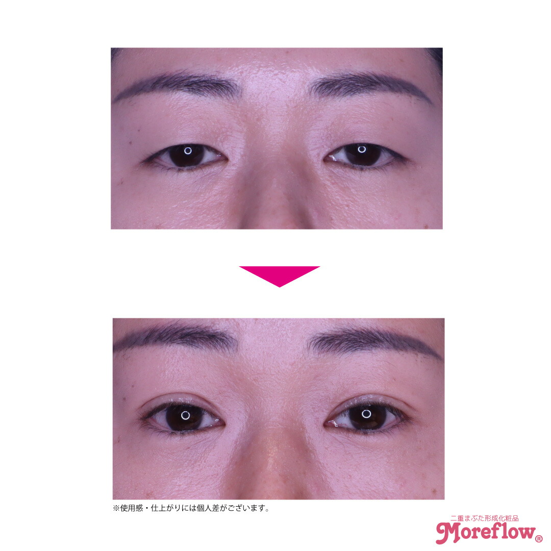 楽天市場】モアフロウ アイリッドリキッド 8ml【送料無料】※レビュー