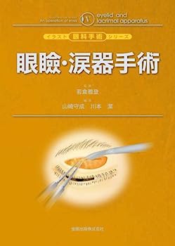 楽天市場】専修医 石嶋くんの眼瞼手術チャレンジノートの通販