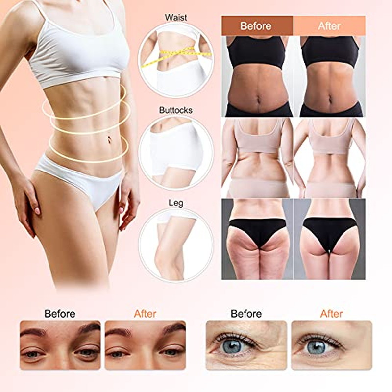 楽天市場】キャビテーション 美容器 40KHz ラジオ波バキューム付 家庭