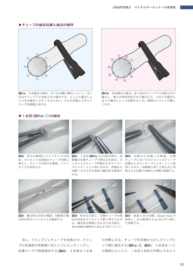 5-Dコンセンサス 歯の保存にこだわる