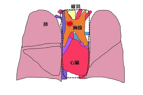 呼吸器外科 | 日本赤十字社 旭川赤十字病院