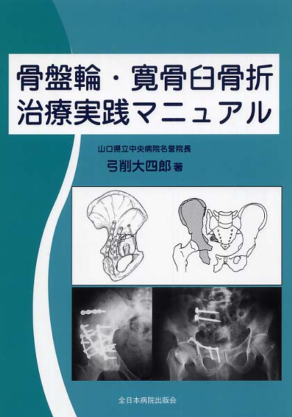 骨盤輪・寛骨臼骨折治療実践マニュアル / 弓削 大四郎【著