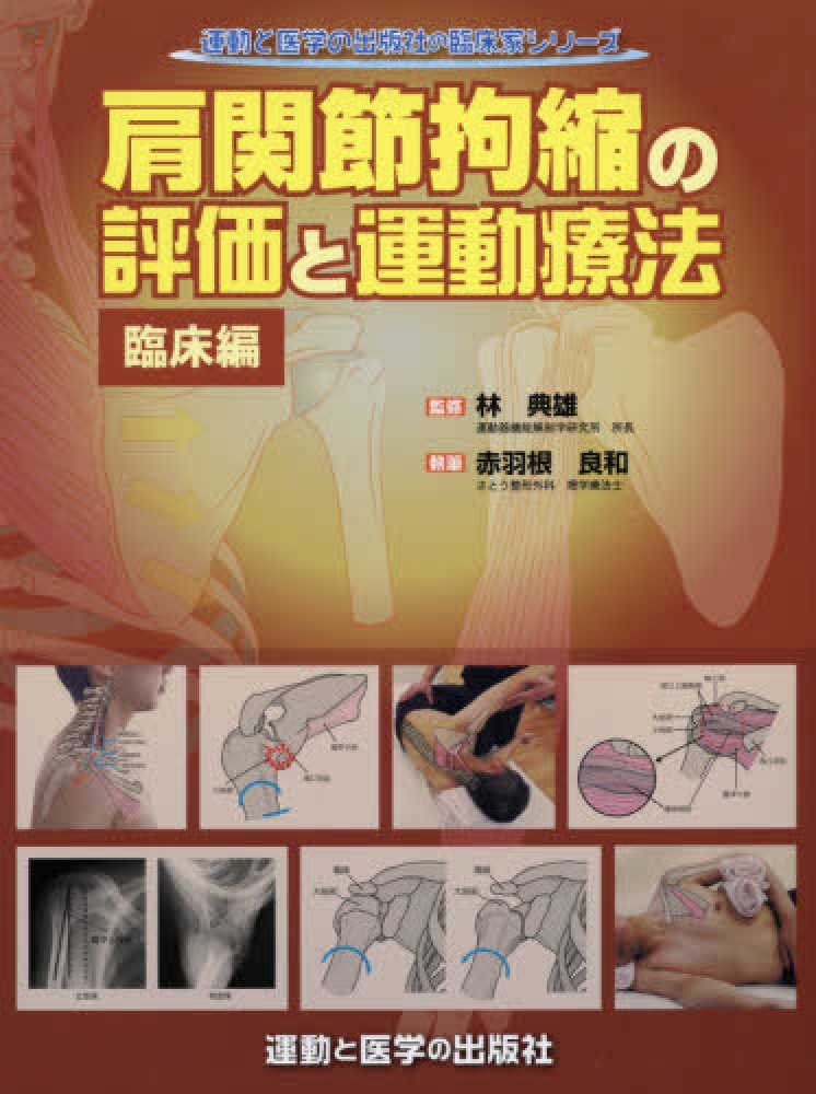 肩関節拘縮の評価と運動療法 臨床編 / 林 典雄【監修】/赤羽根 良和