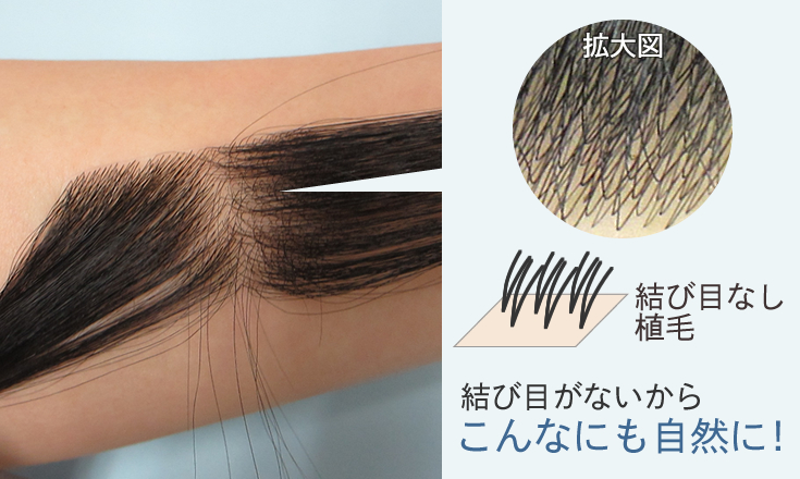 生え際を増毛 | はえぎわくん