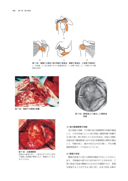 肩その機能と臨床_立ち読み