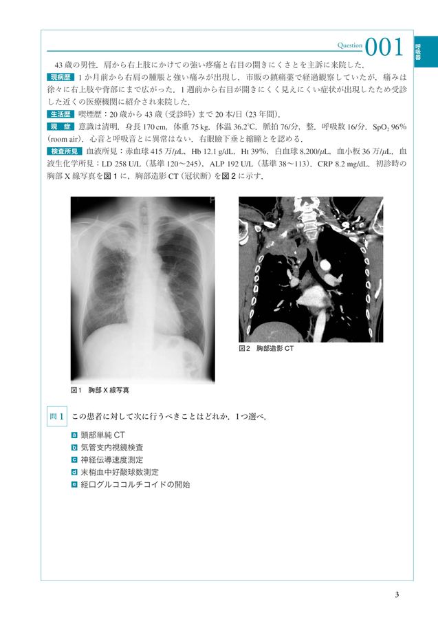 THE総合内科ドリル (Ver.2) 2 WEB版付_立読み