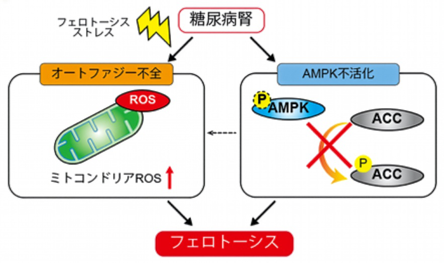 松井 翔、山本 毅士、猪阪 善隆 ≪腎臓内科学≫ 糖尿病腎でフェロ