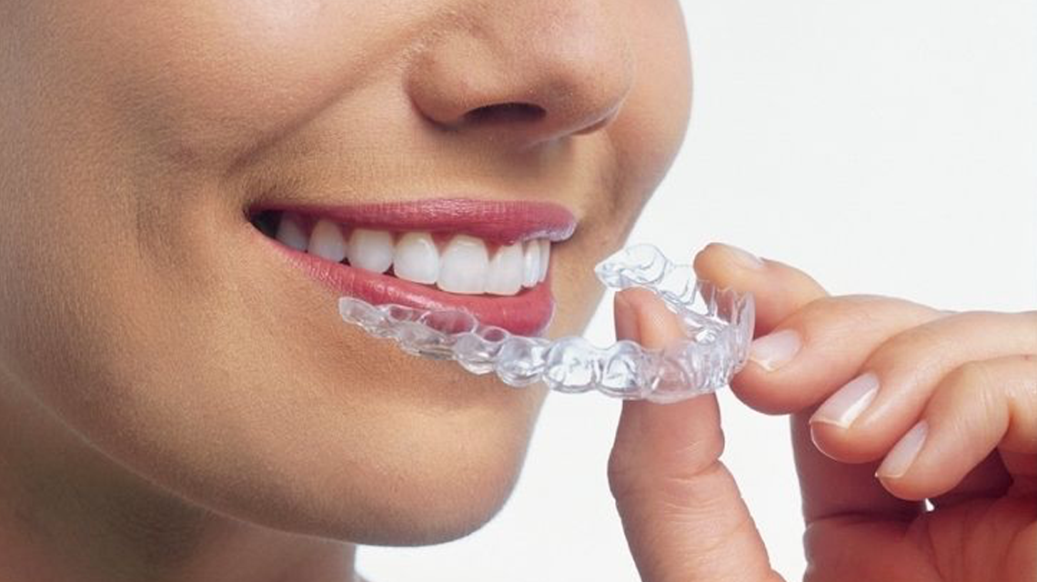 3Dデジタル矯正｜自由が丘の歯医者 自由が丘シーズ歯科・矯正歯科