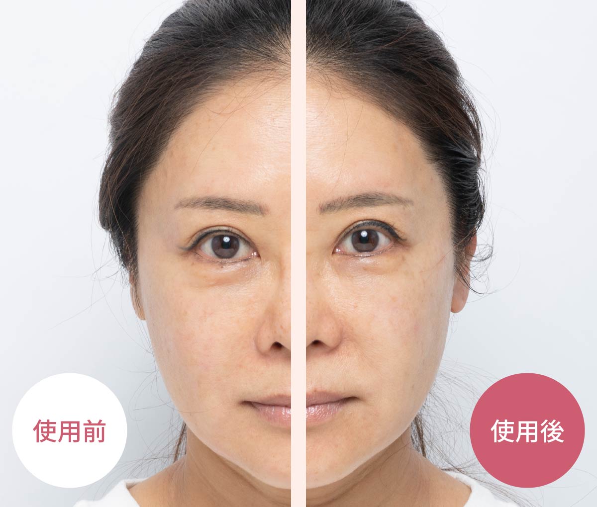 RF美顔器『フォトプラスシャイニー 』ヤーマン公式通販サイト