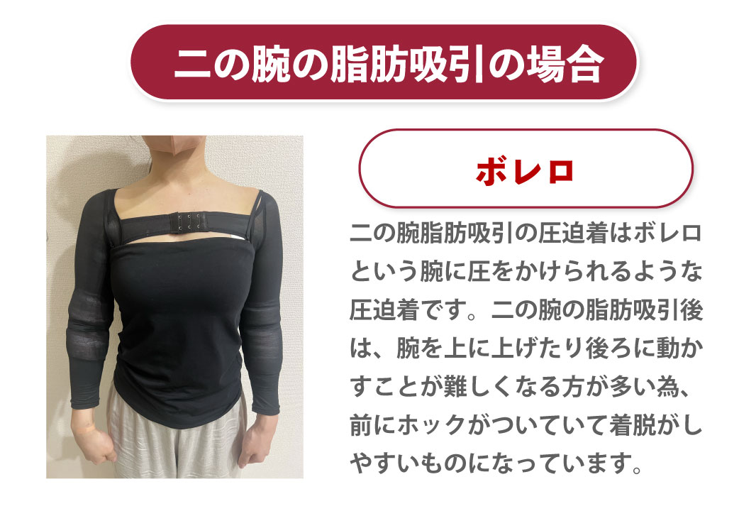 脂肪吸引の圧迫はいつまですればいい？しなかった場合はどうなるのかも