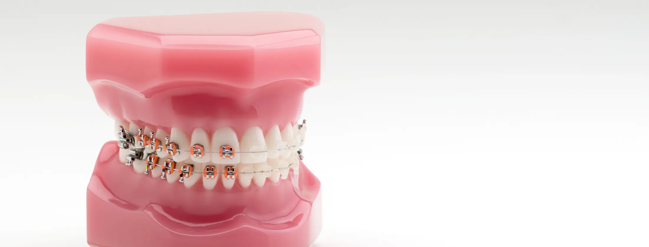 多摩市で専門の医師による目立たない矯正歯科治療｜友達や同僚に気づか