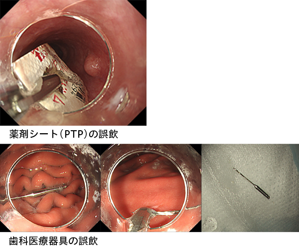 内視鏡センター｜社会医療法人三栄会 ツカザキ病院