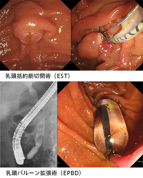 内視鏡センター｜社会医療法人三栄会 ツカザキ病院