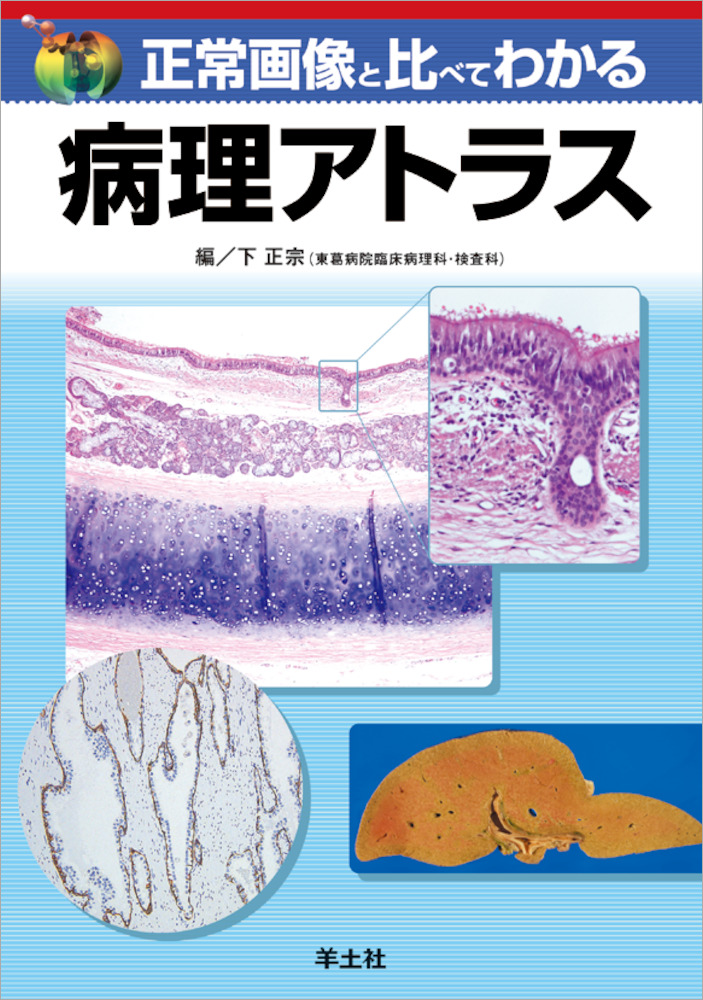正常画像と比べてわかる 病理アトラス - 羊土社