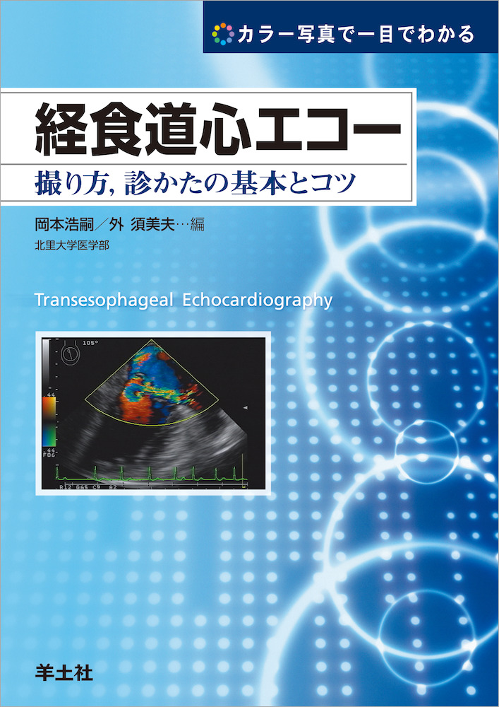 カラー写真で一目でわかる 経食道心エコー〜撮り方，診かたの基本と