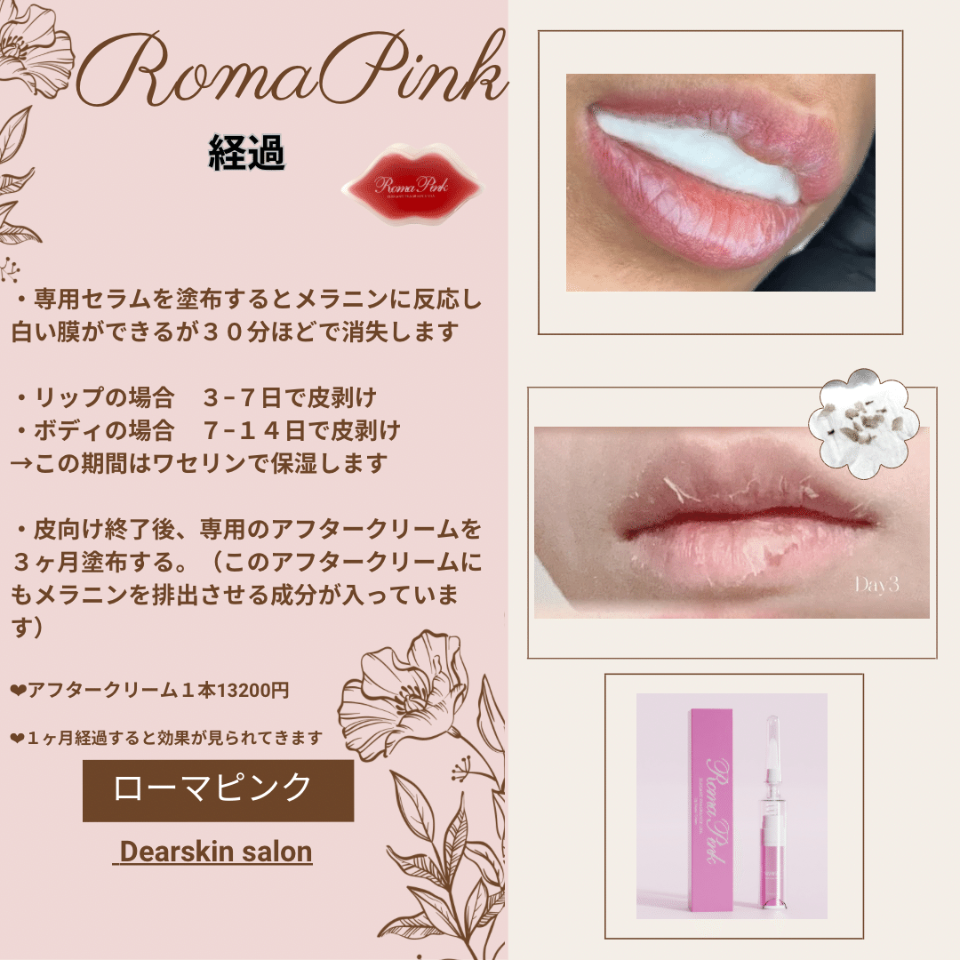 ローマピンクRomaPinkアフタークリーム20本 ローマピンクRomaPink