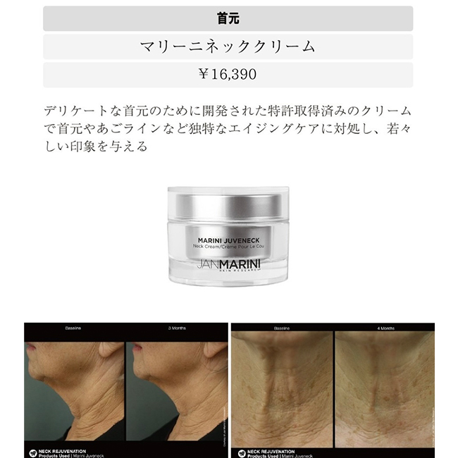 首のシワが気になる！改善する方法は？原因やマッサージの効果も美容