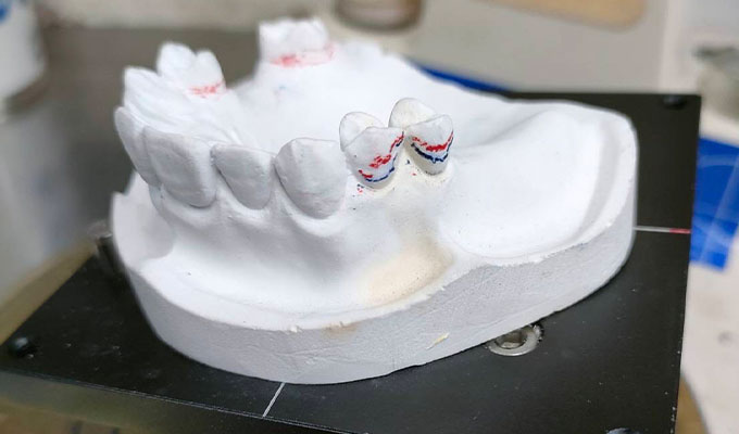 横浜市青葉区｜義歯治療専門｜あざみ野すずき歯科クリニック