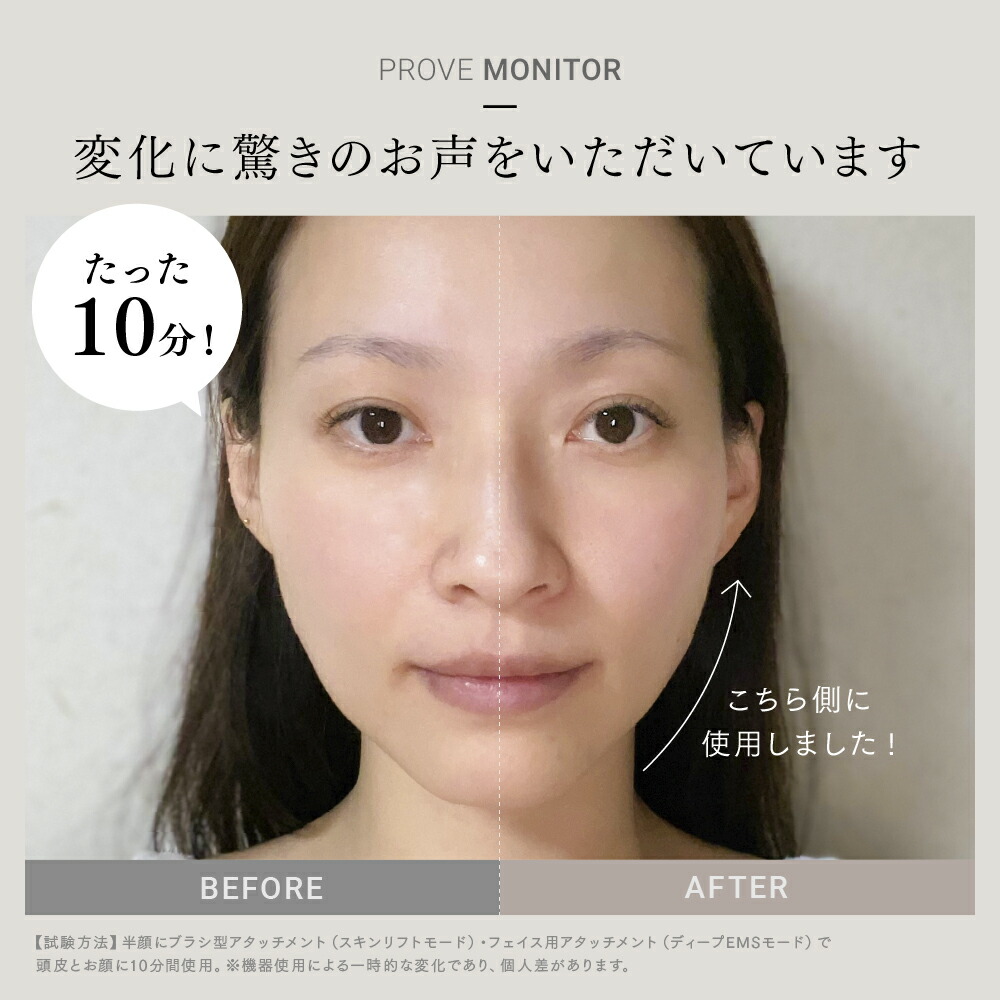 MYTREX マイトレックス PROVE(プルーヴ)