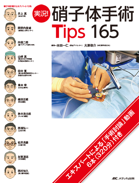 m3電子書籍 | 連続写真と動画で学ぶ白内障手術パーフェクトマスター