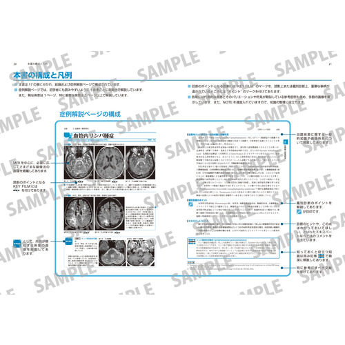画像診断別冊KEYBOOKシリーズ|よくわかる脳MRI 改訂第4版