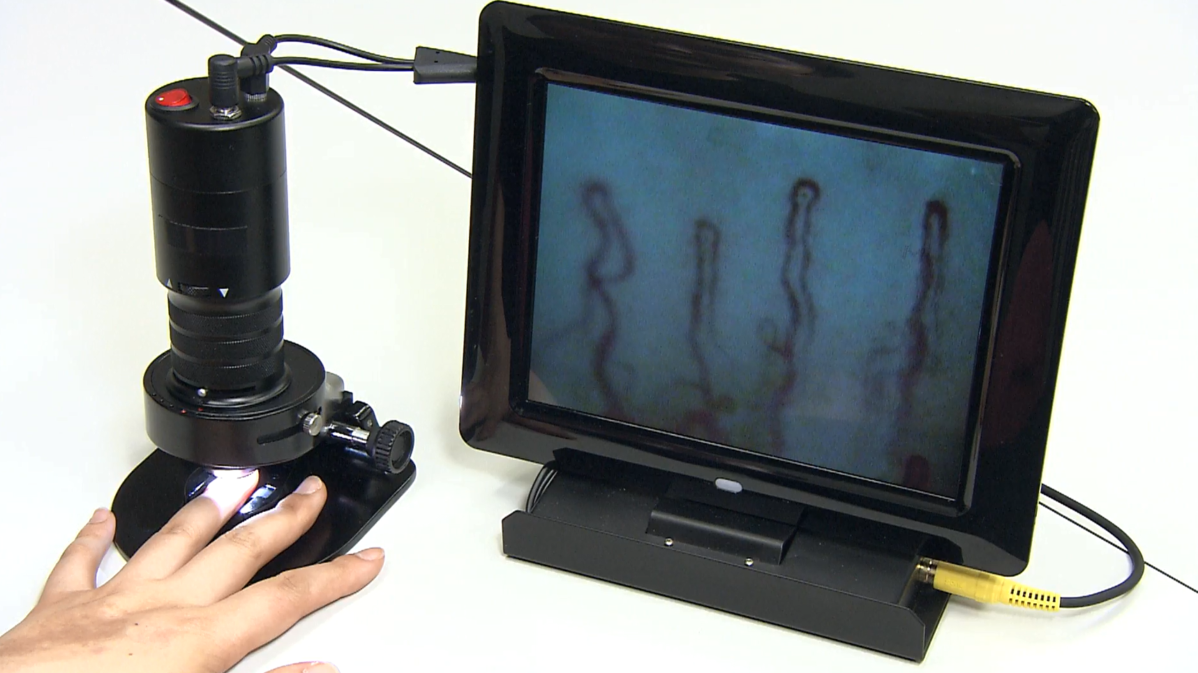 血管美人【毛細血管スコープ・血流スコープ】｜トレーニングマシンの