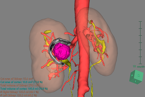 Urological Surgery | Fujifilm Healthcare