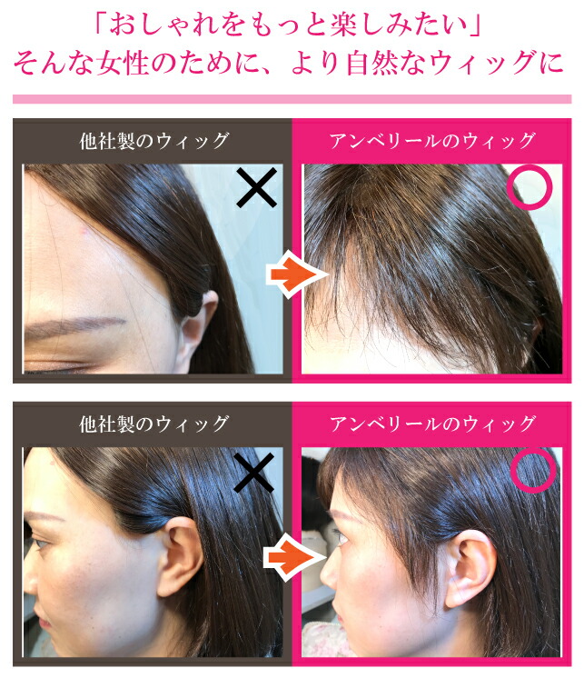 楽天市場】 医療用ウィッグ スーパーハイグレード : ウィッグの