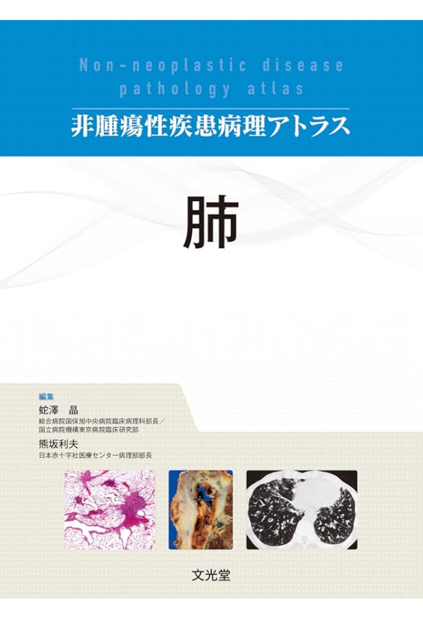 Amazon.co.jp: 非腫瘍性疾患病理アトラス 骨関節 : 石田 剛, 今村哲夫