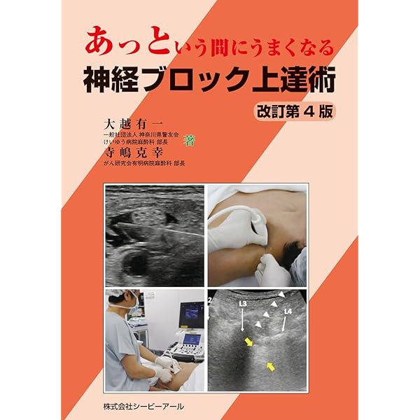 Amazon.co.jp: 神経ブロックに必要な画像解剖 (痛みのScience