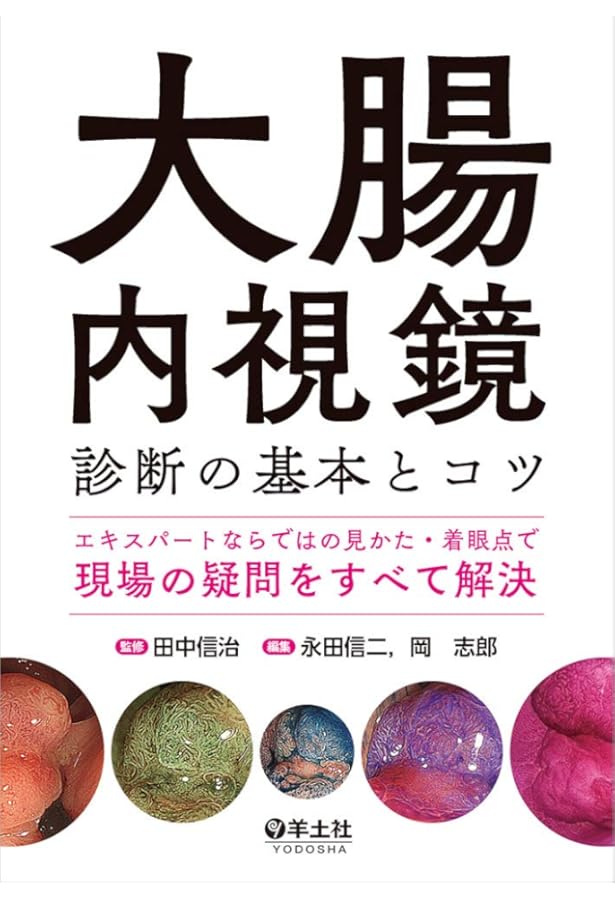 上部消化管内視鏡診断の基本とコツ〜内視鏡検査の「実際どうする？」を