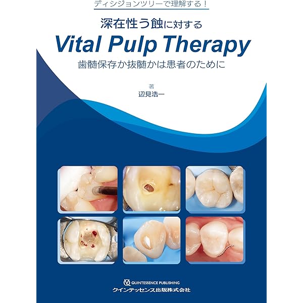 Amazon.co.jp: スリーステップ秋山メソッドBASIC : 秋山勝彦: Japanese