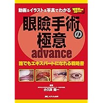 動画＆イラスト＆写真でわかる眼瞼手術の極意 advance：誰でも