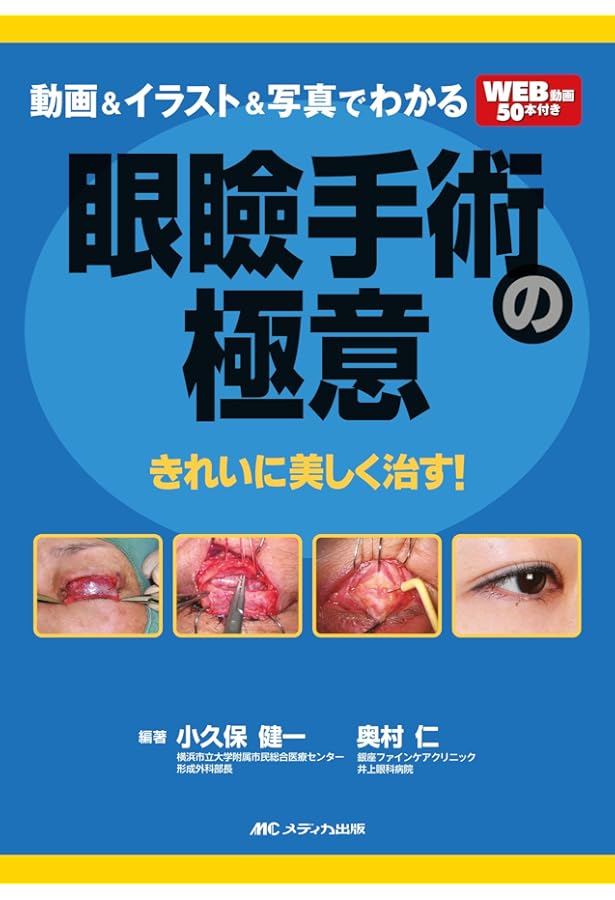 Amazon.co.jp: 眼形成手術: 眼瞼から涙器まで (眼科臨床エキスパート