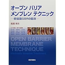 シングル・トゥースインプラント: 前歯部および臼歯部抜歯窩に対する低