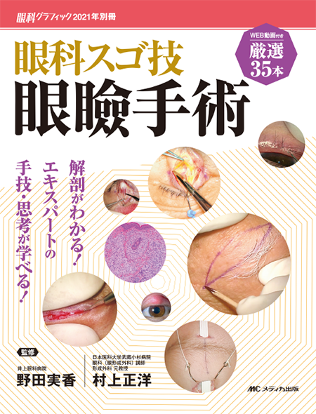 m3電子書籍 | 専修医 石嶋くんの眼瞼手術チャレンジノート
