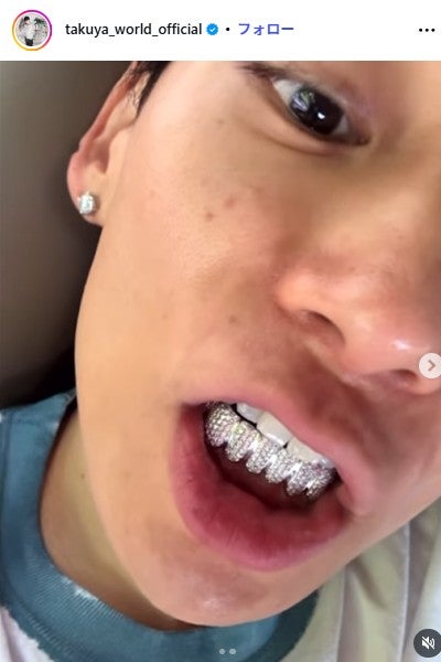 UVERworld・TAKUYA∞「不評No.1ジュエリー」装着動画に驚きの声