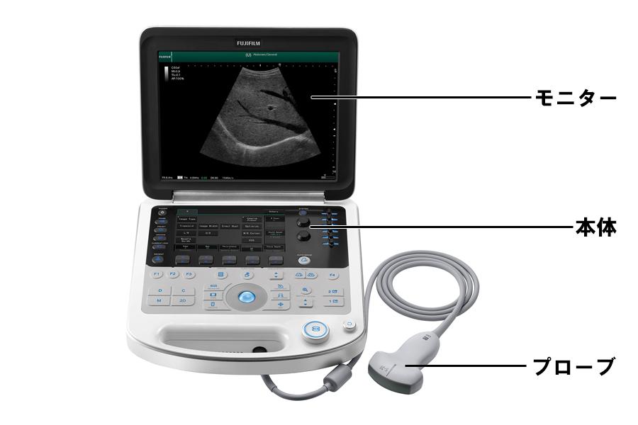 エコー（超音波）機器の特徴と取り扱い注意点 | 看護roo![カンゴルー]
