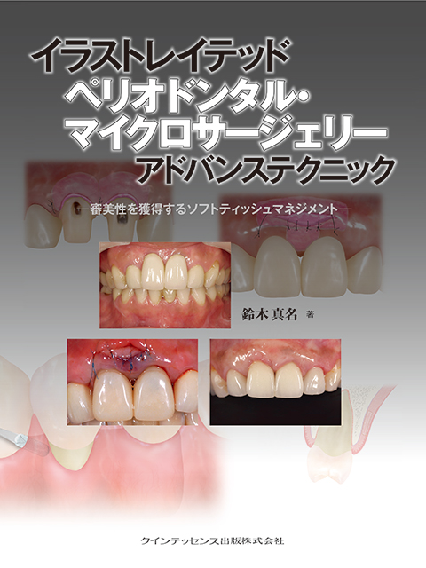 イラストレイテッド ペリオドンタル・マイクロサージェリー アドバンス