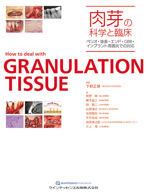 イラストでみる口腔外科手術 第3巻 - クインテッセンス出版