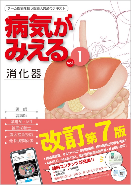 新刊（改訂版）］『病気がみえるvol.1 消化器（第7版）』 本日発売