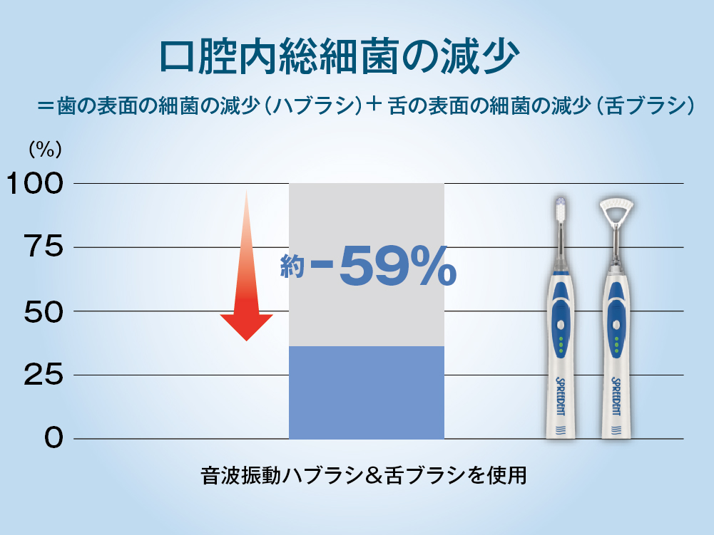 音波振動ハブラシ 交換用ブラシ（舌用4個入り）) ：Amway(日本