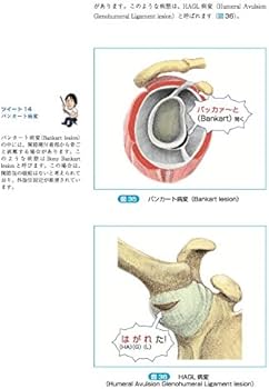 林典雄の運動器疾患の機能解剖学に基づく評価と解釈 上肢編 (運動と