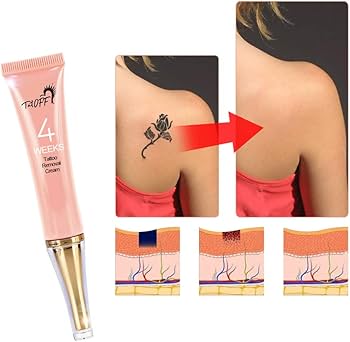 Amazon.co.jp: タトゥー除去クリーム、13gタトゥー除去クリームプロの