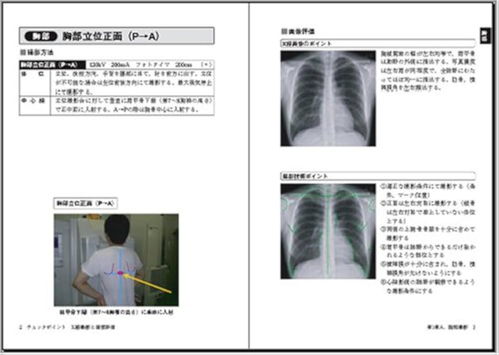 チェックポイントX線撮影と画像評価: 救急医療・当直現場で役立つ
