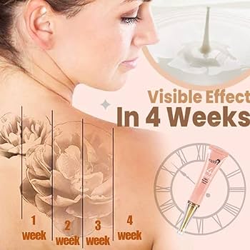 Amazon | タトゥー除去クリーム 刺青除去クリーム 13g 永久的 タトゥー