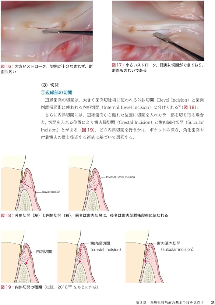 ゼロから見直す歯周外科治療 | 松延 允資 |本 | 通販 | Amazon