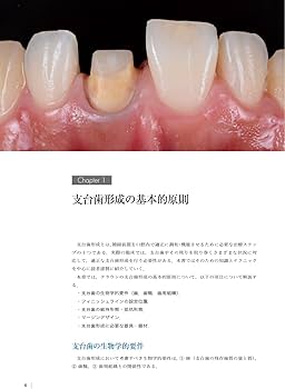 The Tooth Preparation: 補綴修復治療の成功を目指した支台歯形成