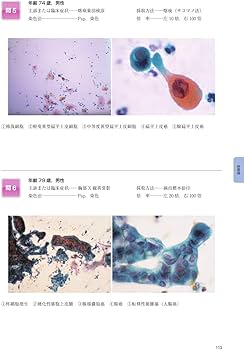 細胞検査士細胞像試験問題集 第2版 | 公益社団法人日本臨床細胞学会