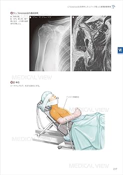 肩関節手術のすべて | 菅谷 啓之, 秋田 恵一(編集協力), 二村 昭元